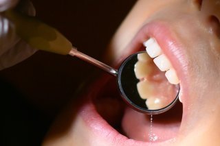 Les Suisses ont de bien meilleures dents qu'il y a 20 ans. KEYSTONE/DPA/JULIAN STRATENSCHULTE